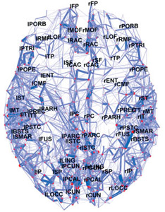 diffusion spectrum imaging 